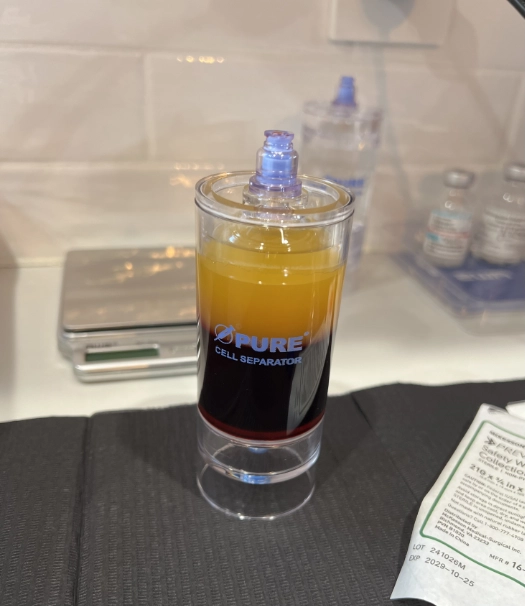 Emcyte PRP Harvest