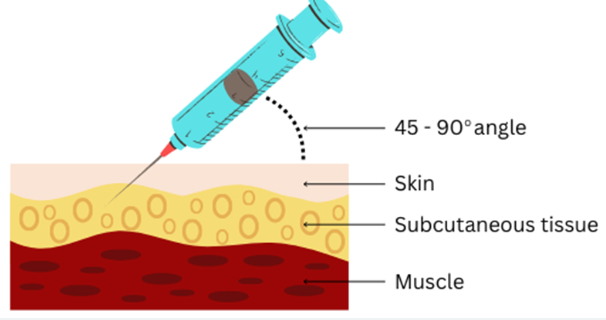 Subcutaneous injection angle of 45 to 90 degrees